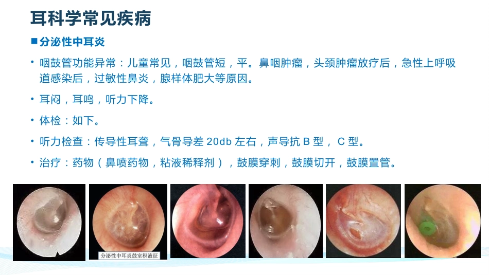 耳鼻喉常见疾病_第8页