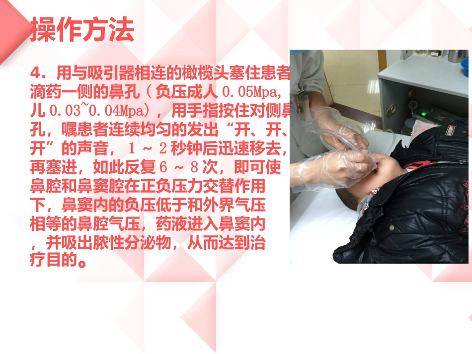 鼻负压置换的操作_第7页