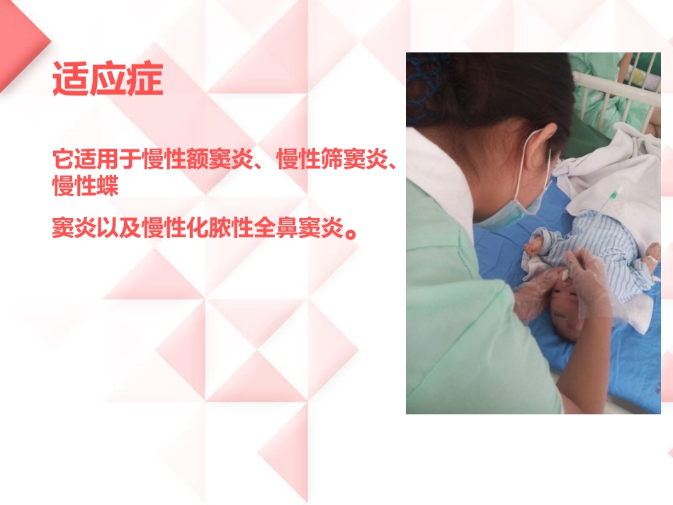 鼻负压置换的操作_第9页
