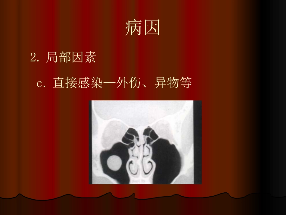 鼻窦炎性疾病_第10页