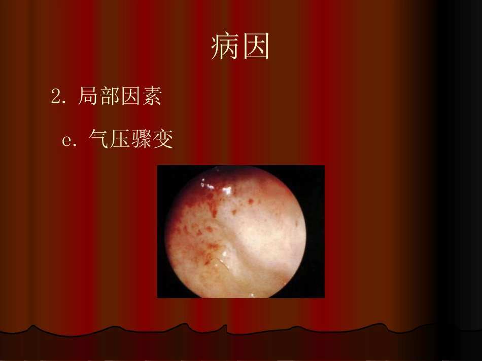 鼻窦炎性疾病_第12页
