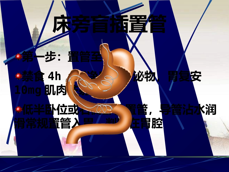 鼻胃肠管盲插方法及管理 PPT_第10页