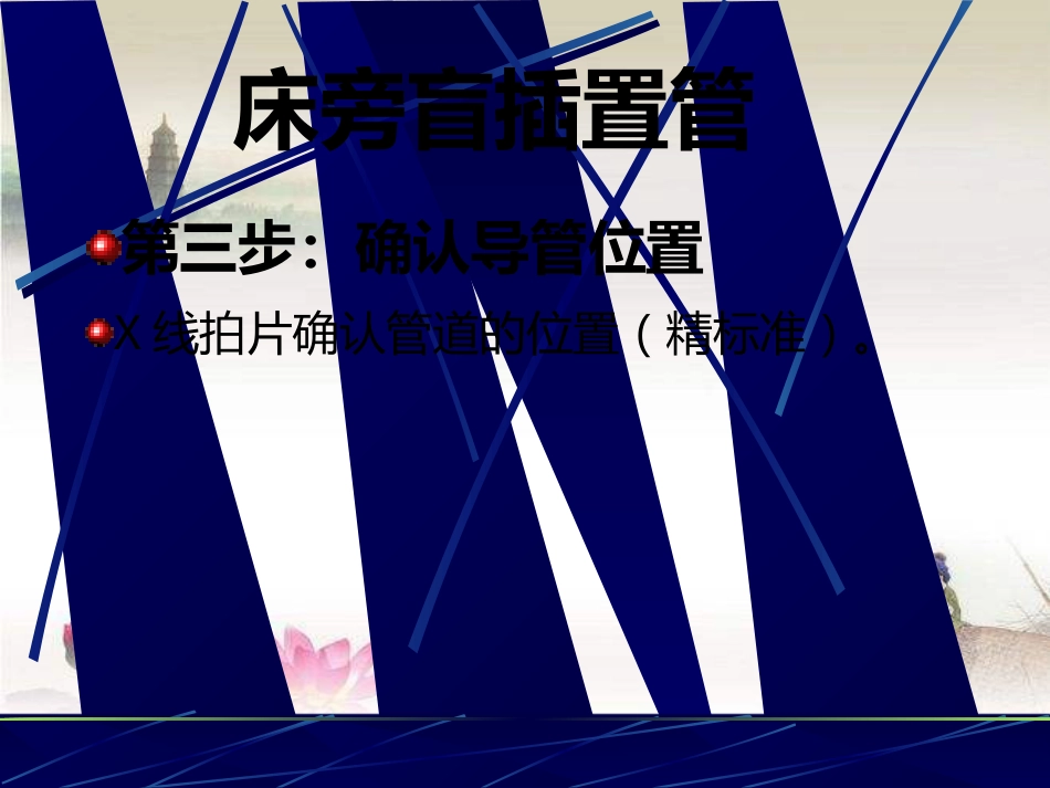 鼻胃肠管盲插方法及管理 PPT_第13页