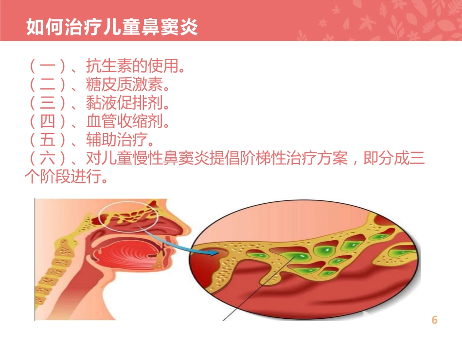儿童鼻窦炎的规范化治疗_第6页