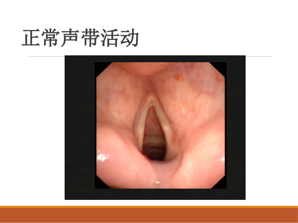 喉的神经性疾病(讲解)_第2页