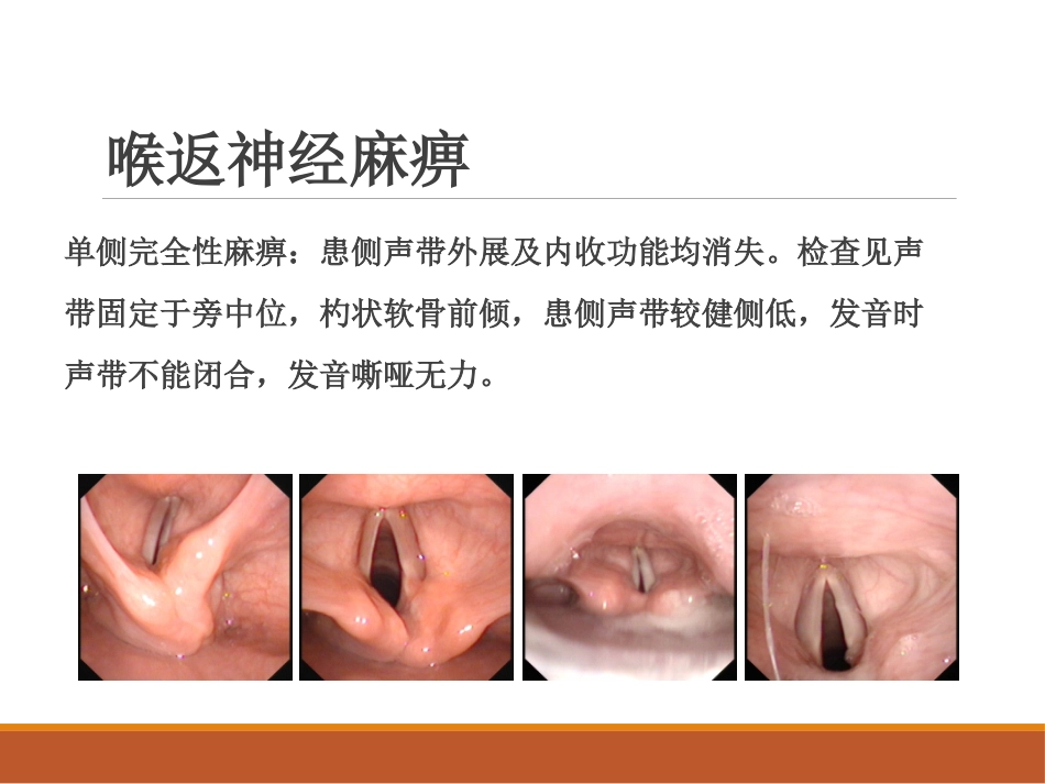 喉的神经性疾病(讲解)_第9页