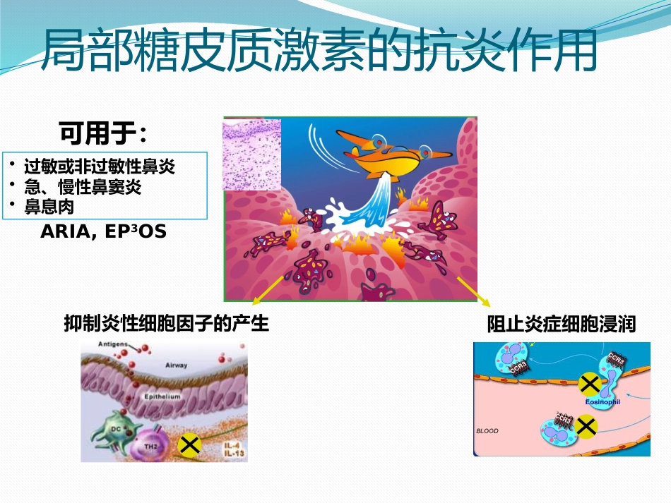 变应性鼻炎鼻内药物治疗_第13页