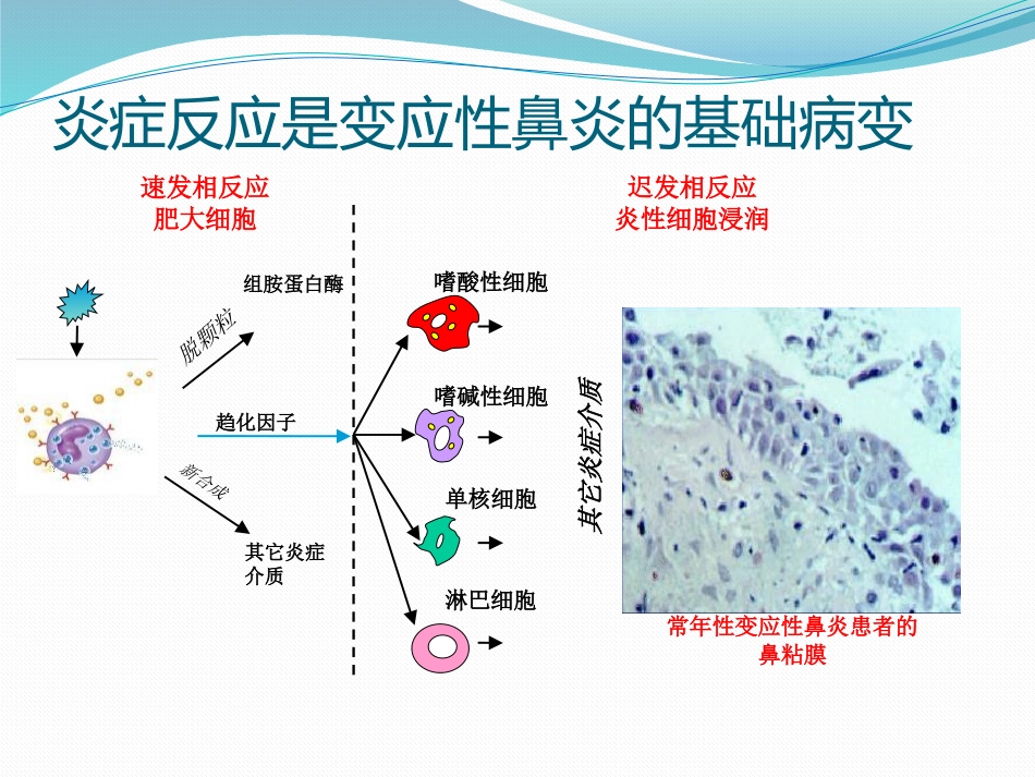 变应性鼻炎鼻内药物治疗_第8页