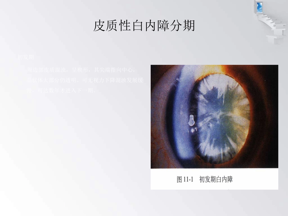 白内障护理查房 (1)_第13页