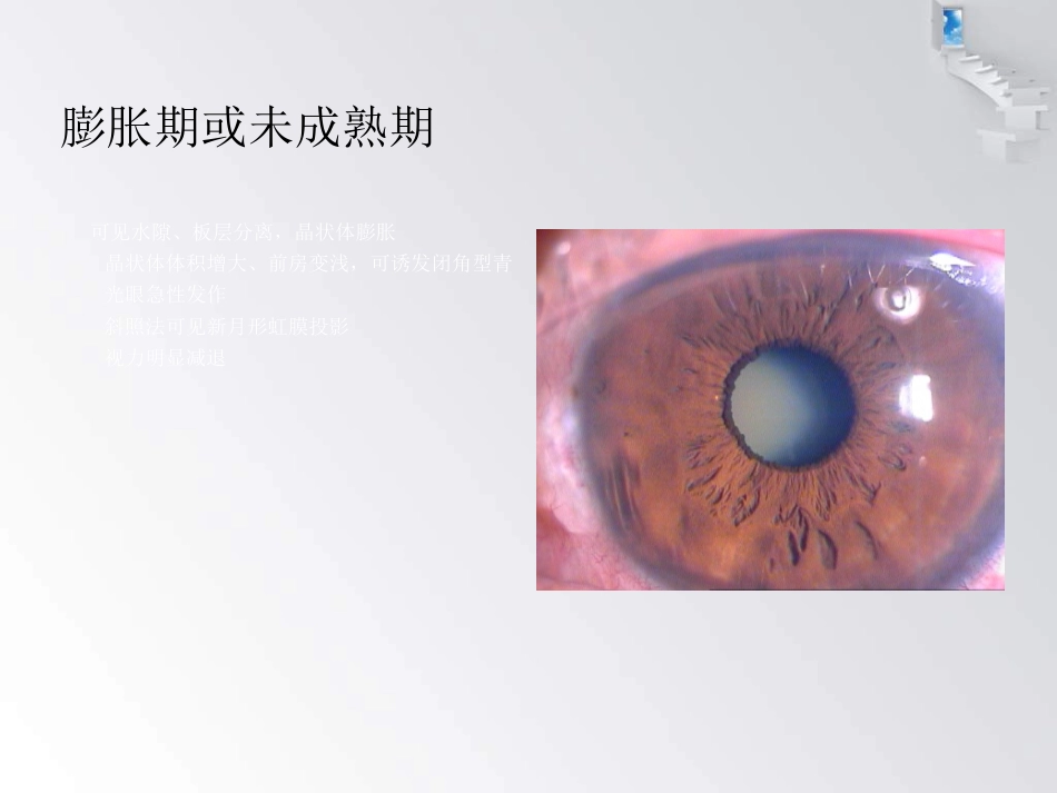 白内障护理查房 (1)_第14页