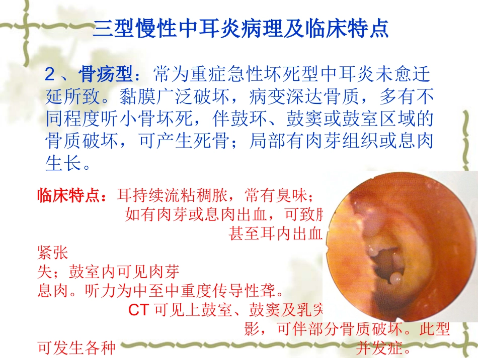 慢性中耳炎(1)_第10页