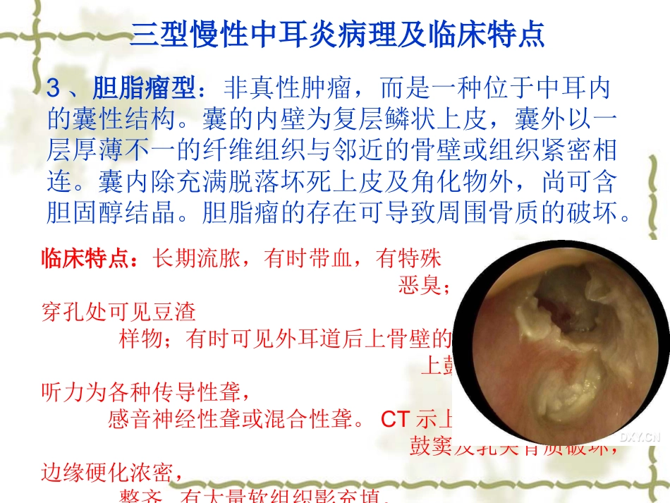 慢性中耳炎(1)_第11页