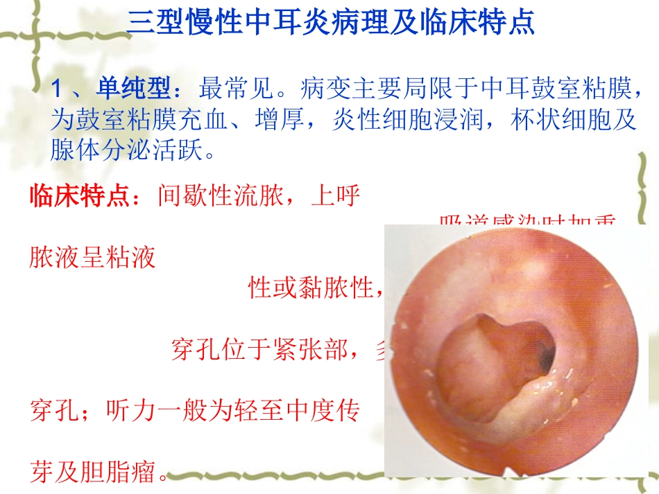 慢性中耳炎(1)_第6页