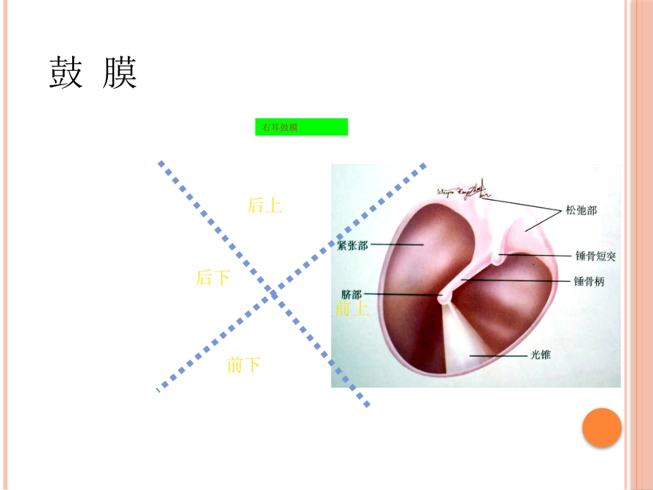 急性中耳炎(1)_第8页