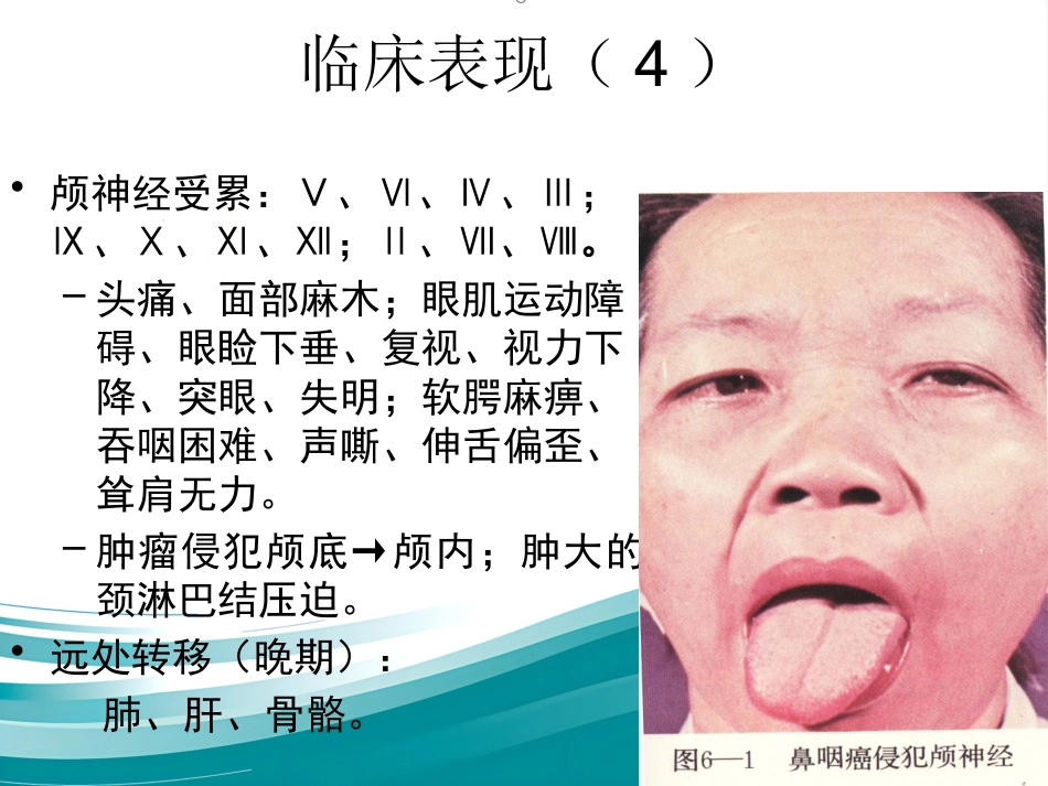 鼻咽癌(1)_第10页