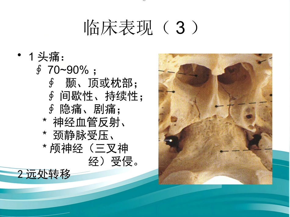 鼻咽癌(1)_第9页