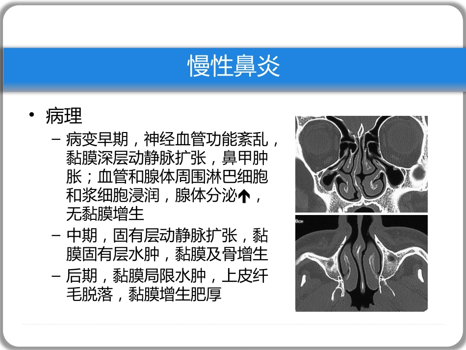 鼻窦炎性疾病(1)_第10页