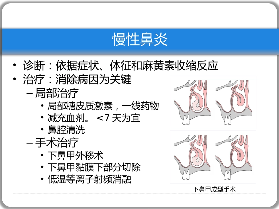 鼻窦炎性疾病(1)_第13页