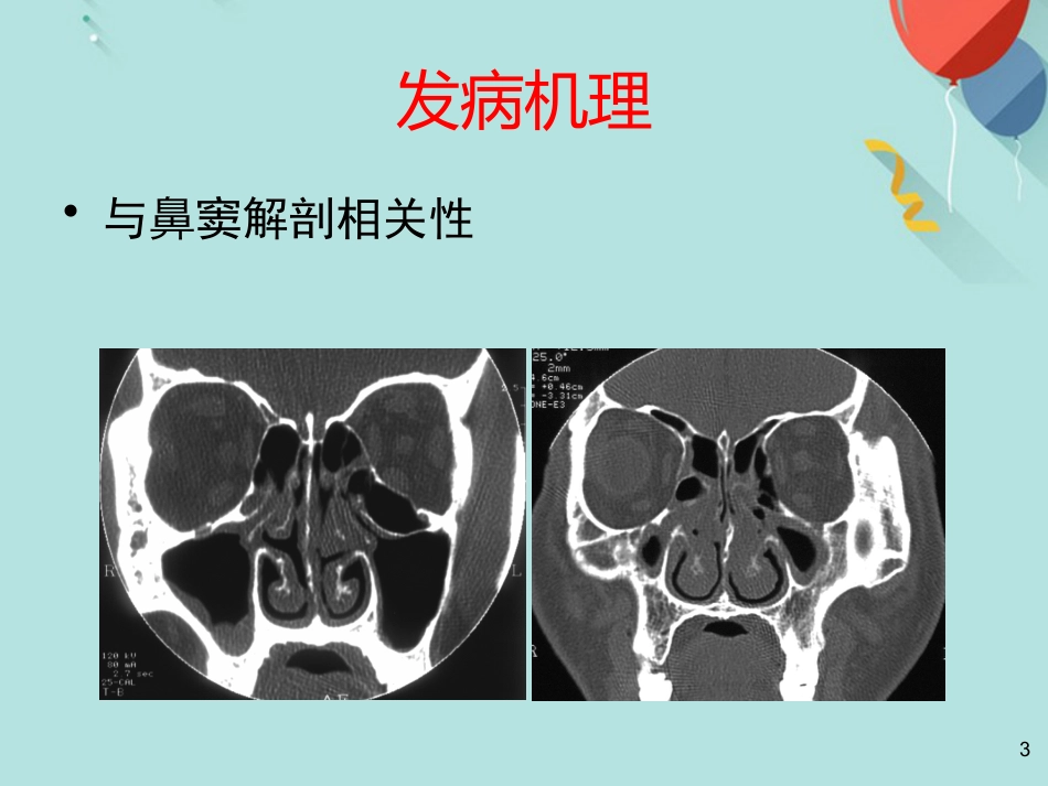 鼻窦炎及并发症PPT课件(1)_第3页