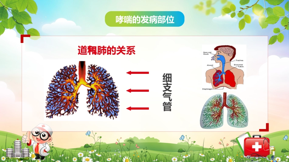 儿童哮喘的防与治4_第6页