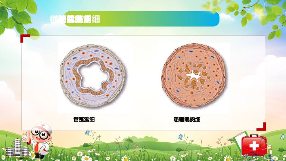 儿童哮喘的防与治4_第8页