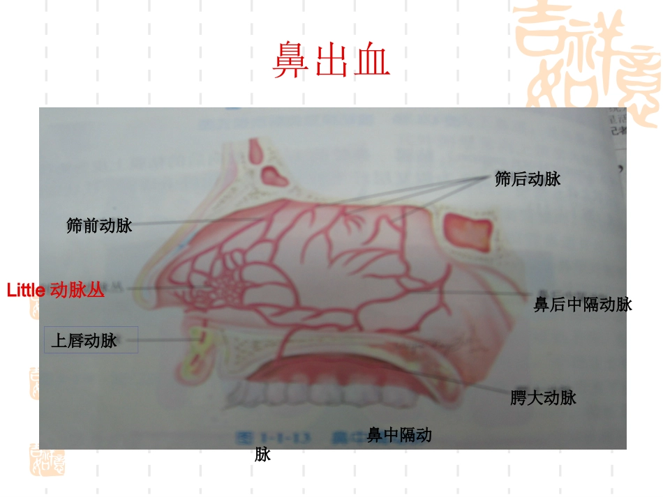 耳鼻喉科常见急症处理1讲诉_第4页