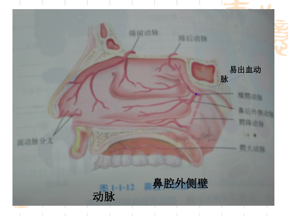 耳鼻喉科常见急症处理1讲诉_第5页