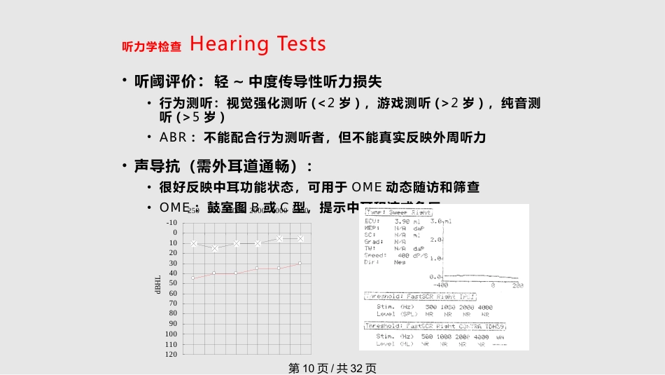儿童分泌性中耳炎诊治(1)_第10页