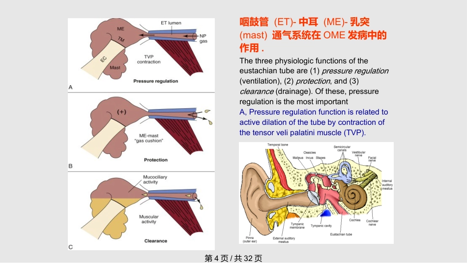 儿童分泌性中耳炎诊治(1)_第4页