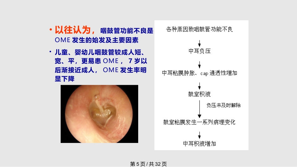 儿童分泌性中耳炎诊治(1)_第5页