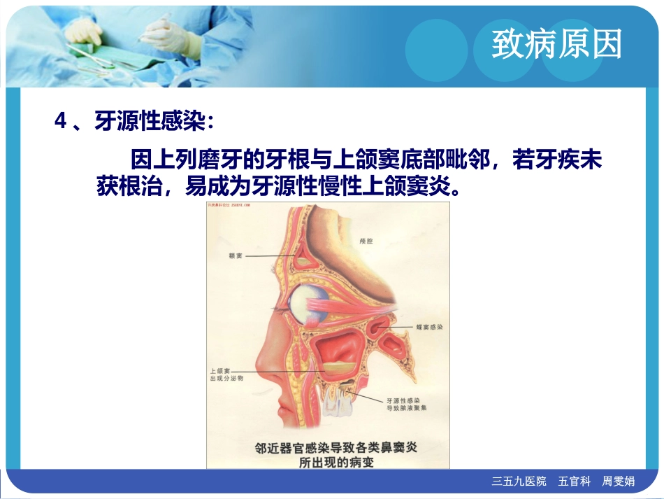 慢性鼻窦炎(1)_第11页