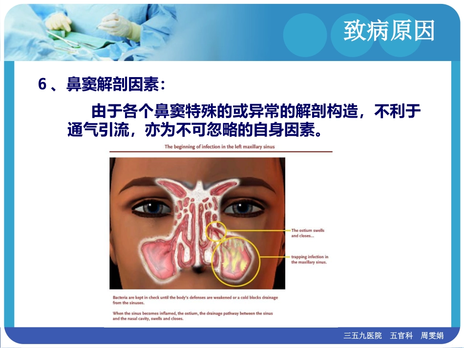 慢性鼻窦炎(1)_第13页