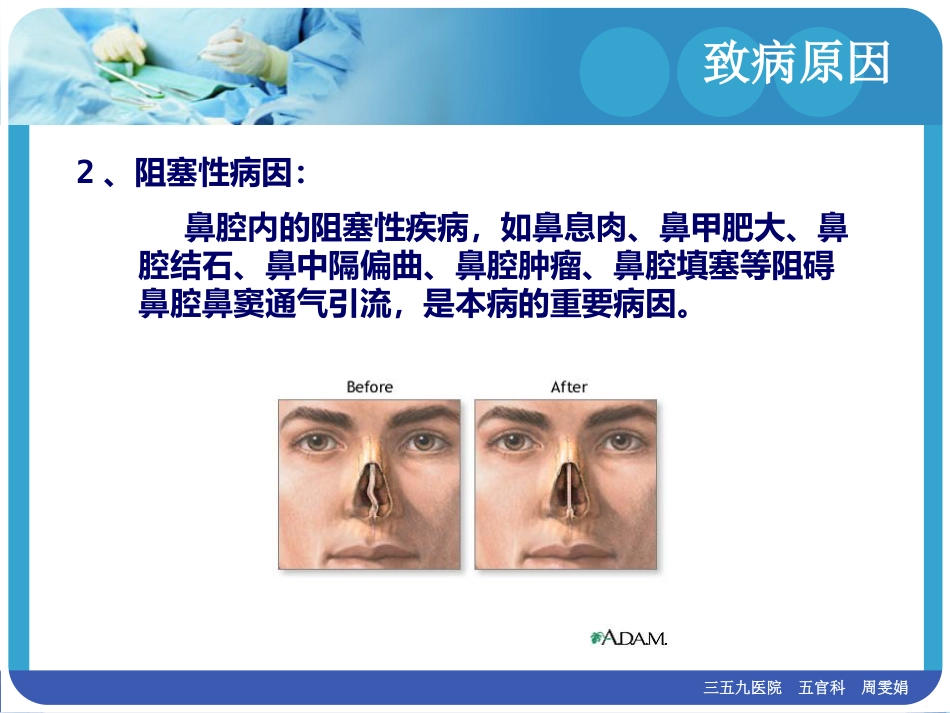 慢性鼻窦炎(1)_第9页