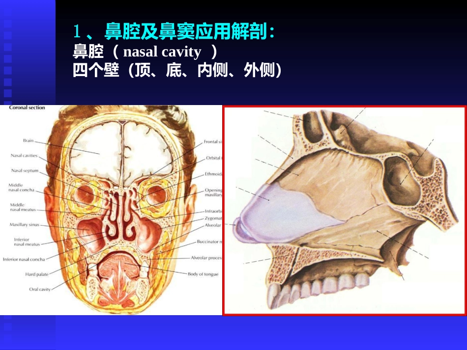 慢性鼻窦炎课件(1)_第4页