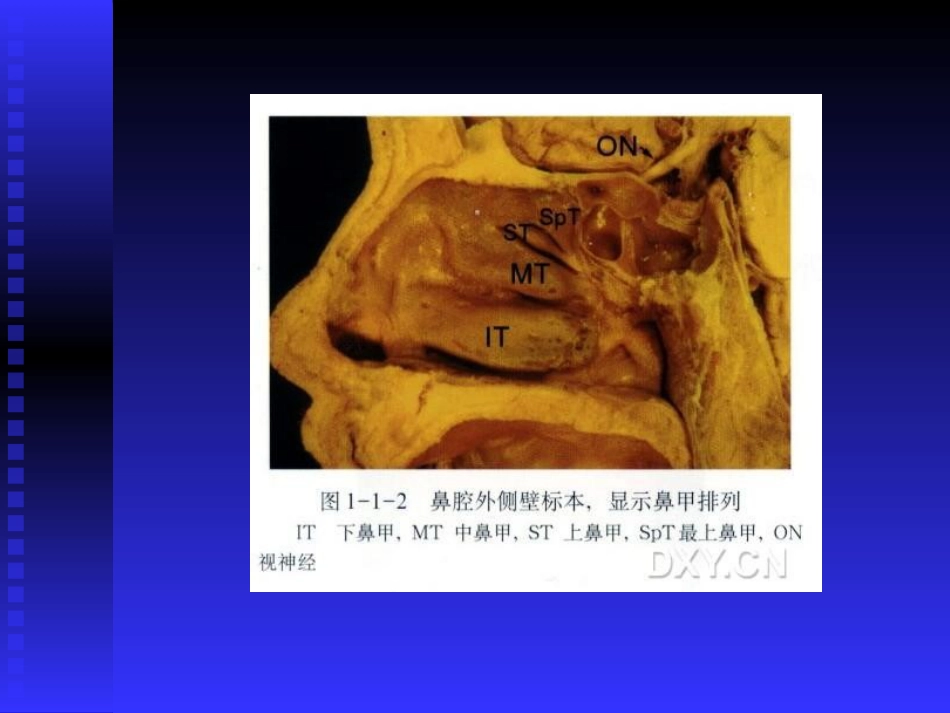 慢性鼻窦炎课件(1)_第8页