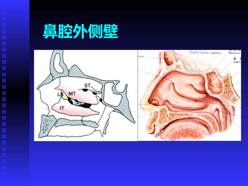 慢性鼻窦炎课件(1)_第9页