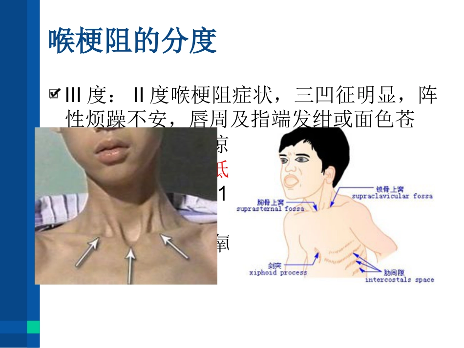 急性喉炎(1)_第9页