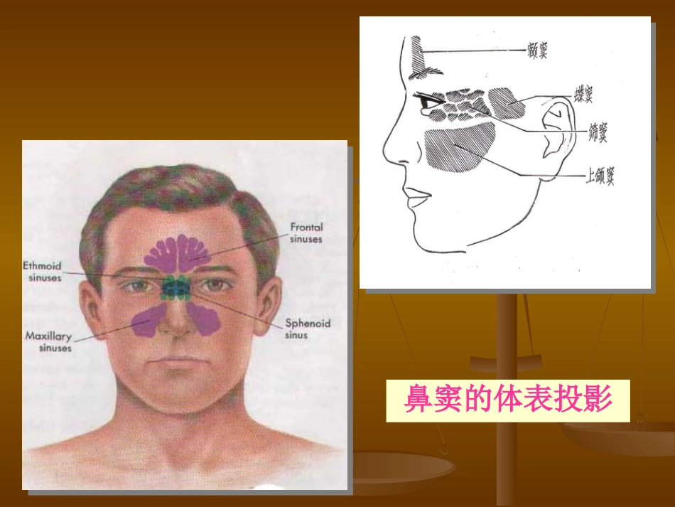 鼻部解剖及生理 (2)_第13页