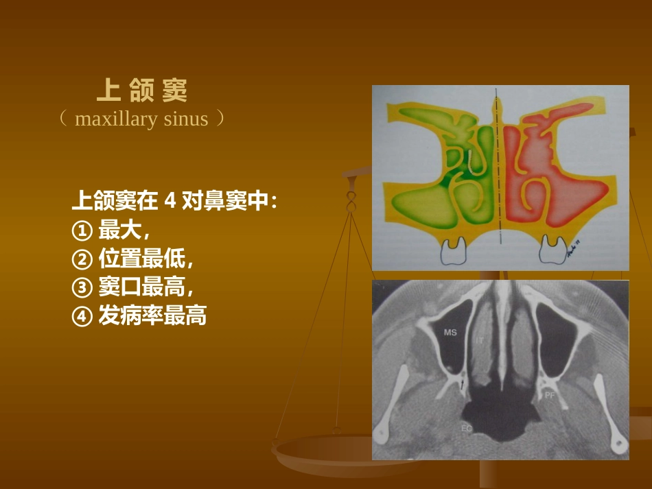 鼻部解剖及生理 (2)_第14页