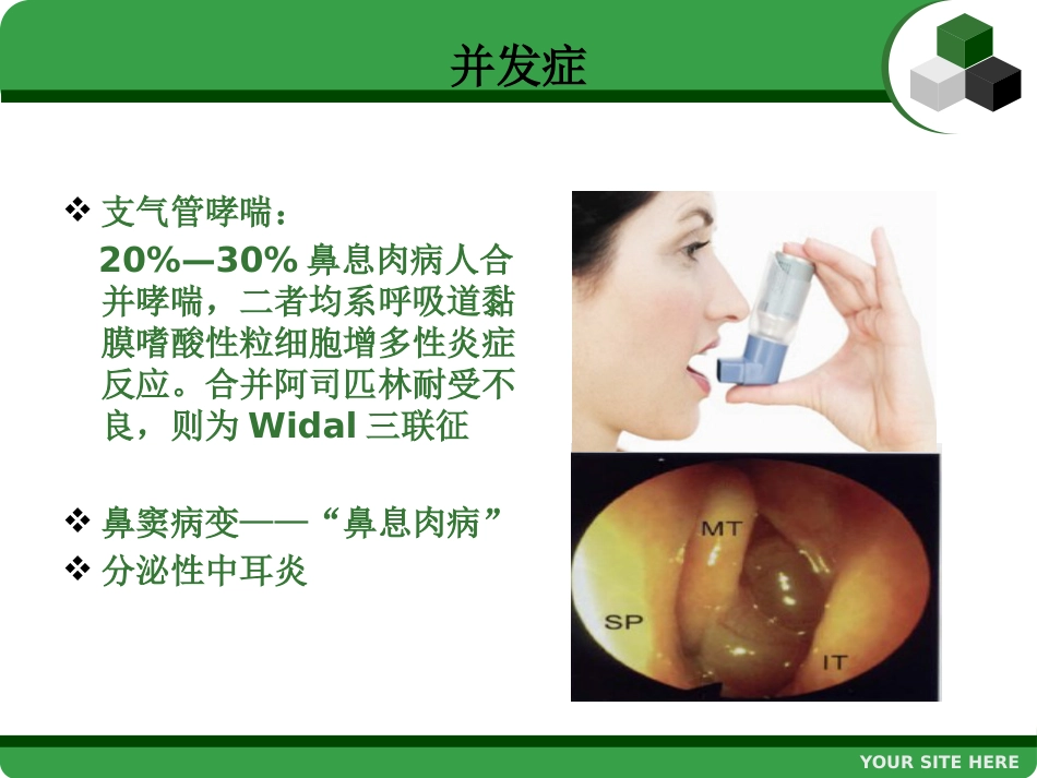 鼻息肉 (2)_第12页