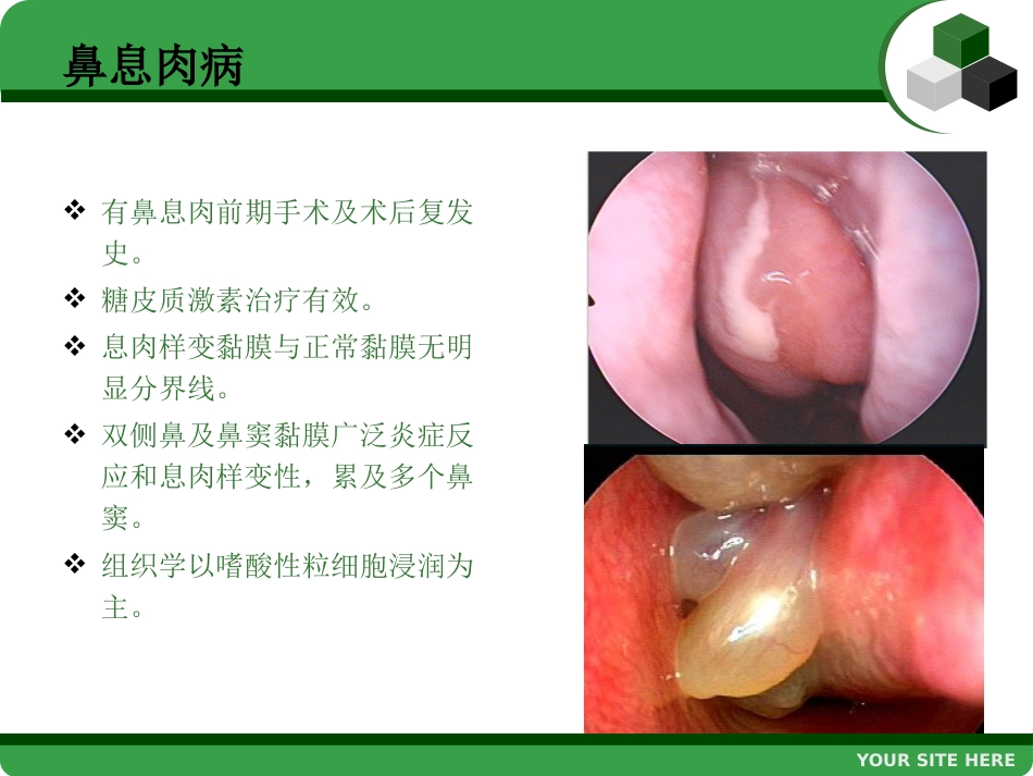 鼻息肉 (2)_第13页
