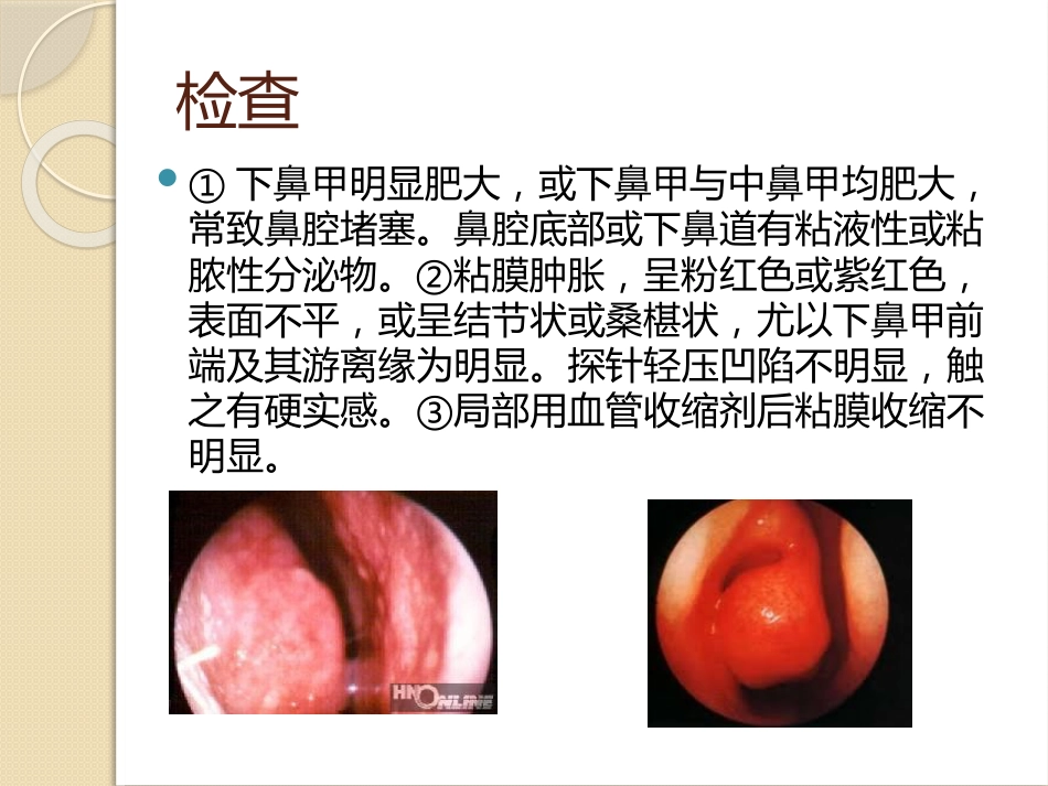 慢性鼻炎(2)_第12页