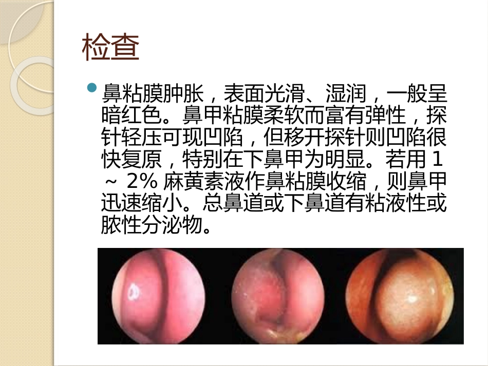 慢性鼻炎(2)_第8页