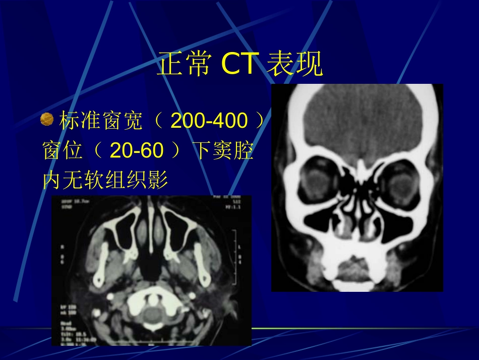 鼻咽癌(2)_第3页