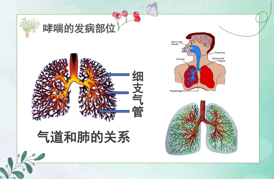 儿童哮喘的防与治5_第6页