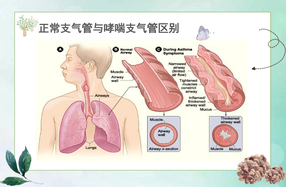 儿童哮喘的防与治5_第7页
