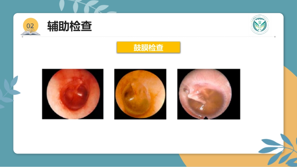 分泌性中耳炎(3)_第10页