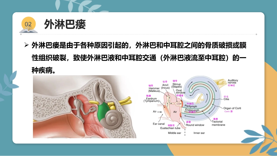 分泌性中耳炎(3)_第15页