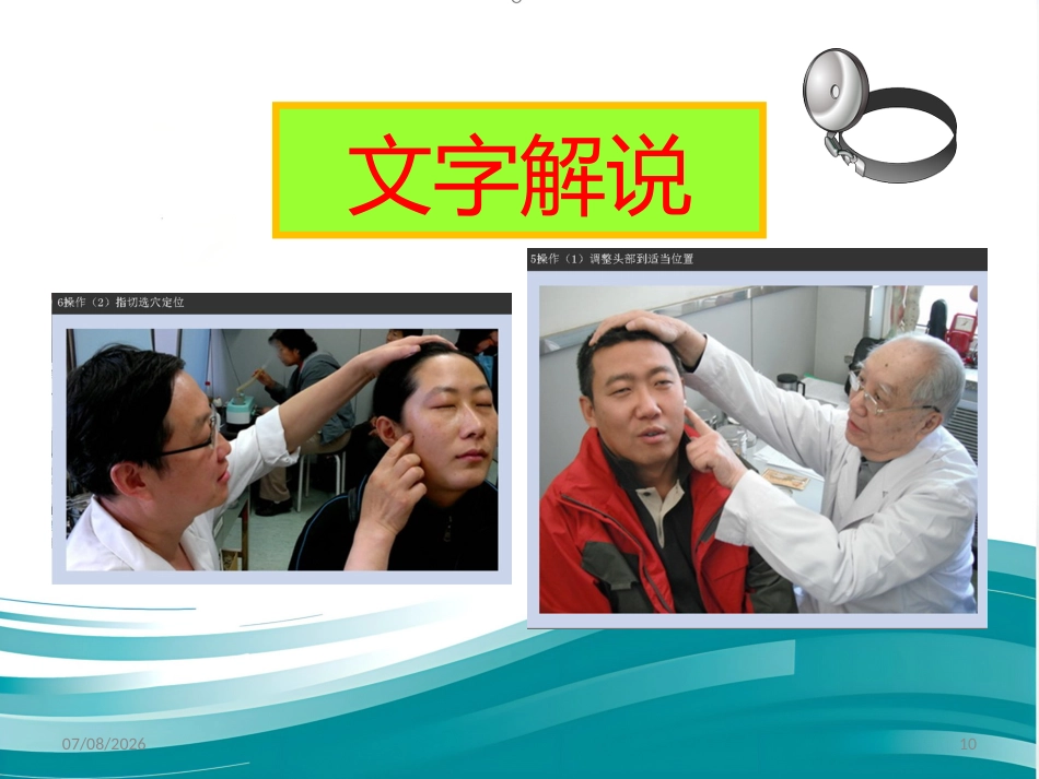 鼻炎 3 穴 讲解精编版_第10页