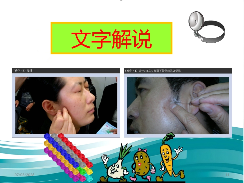 鼻炎 3 穴 讲解精编版_第11页